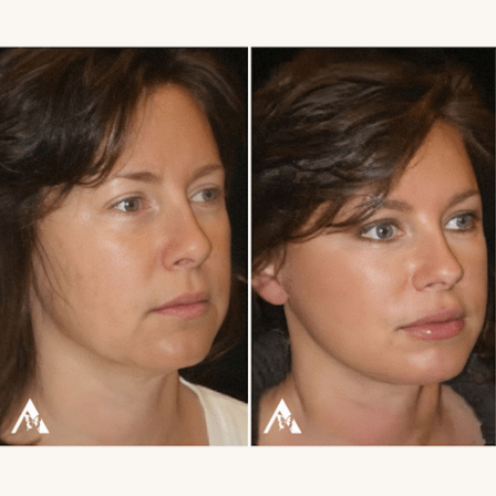 Aesthetica Cosmetic Surgery & Laser Center: Loudoun County Facelift Plastic Surgeon Phillip Chang, M.D.