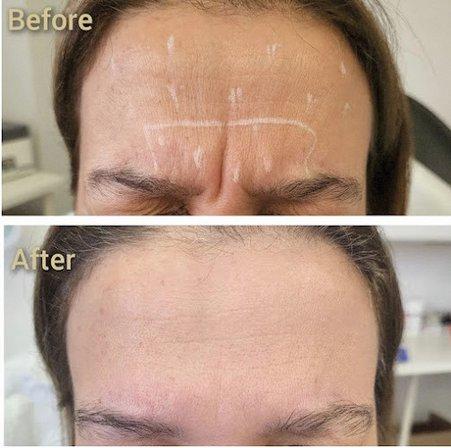 NOVA Hair and Skin Clinic