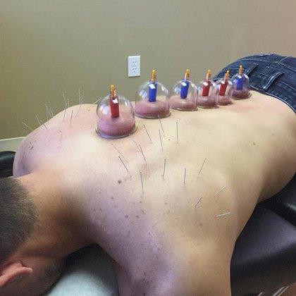 Recharge Sports Injury Center