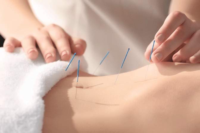 Jan Acupuncture Sterling