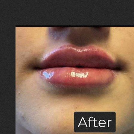 Flawless Skincare and Aesthetics