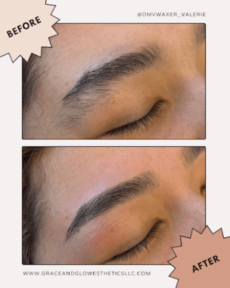 Grace and Glow Esthetics LLC