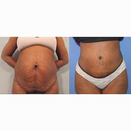 Younger Image Plastic Surgery Center