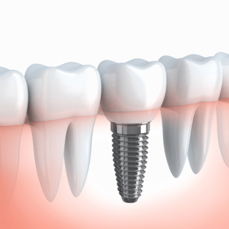 Herndon Dental Arts