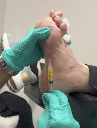 Singh Foot & Ankle Healing Center: Dr. Diltaj Singh and Dr. Shaan Singh