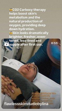 Lina Mendez - Acne anti-aging esthetics spa