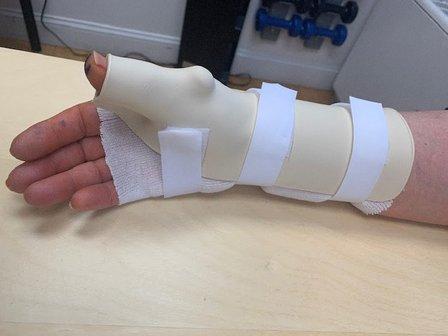 Apex Hand Therapy, LLC