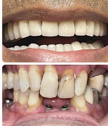 Regal Dental Care