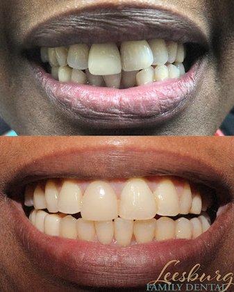 Leesburg Family Dental