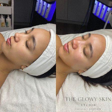 Glowy Skin Studio