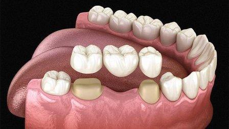 Urgent Dental Care/Smile Centers of America