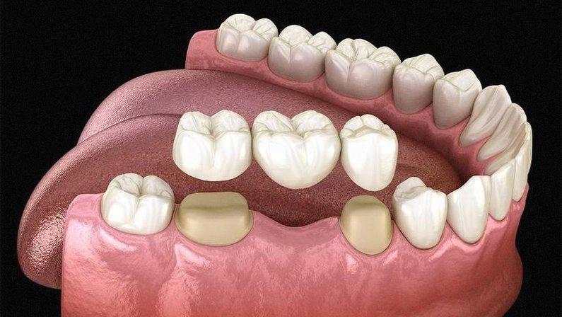 Urgent Dental Care/Smile Centers of America
