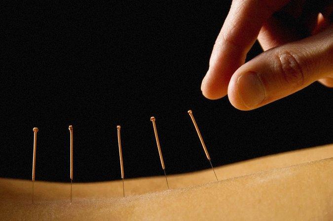 Acupuncture & NAET Center