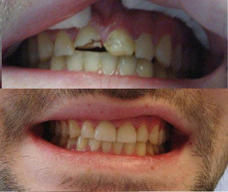Nova Family Dentistry: Dr. Namrata Kaur
