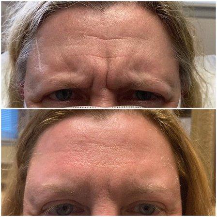 Prolase Medispa - Fairfax