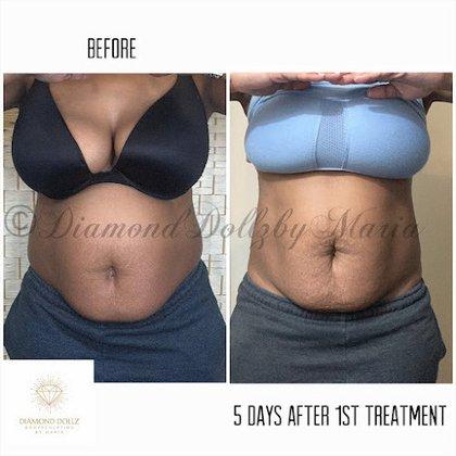Diamond Dollz Body Sculpting LLC