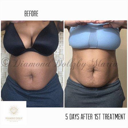 Diamond Dollz Body Sculpting LLC