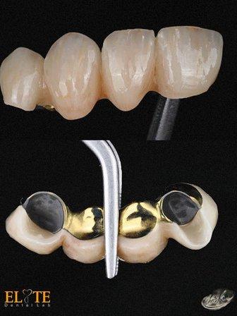 Elite dental lab