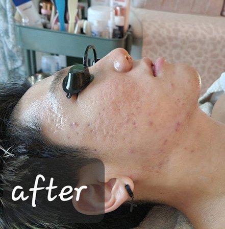 Skincare Namu/Face Pilates