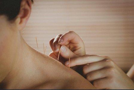 Acupuncture Pain Care LLC