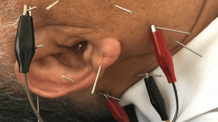 Tammy L. Cashion, DC: VA Board of Medicine Qualified to Practice Acupuncture