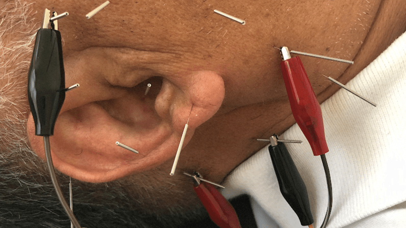 Tammy L. Cashion, DC: VA Board of Medicine Qualified to Practice Acupuncture